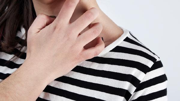 越来越多的人患有湿疹！医生强调：家里久置的3个物品，或是起因