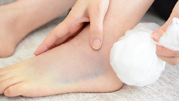 睡醒感觉脸有点浮肿