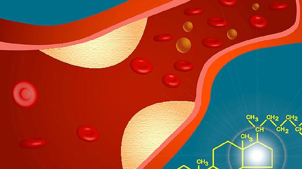 马上停止喝这4种饮料，喝得越多，血管或越堵？医生给出明确答案