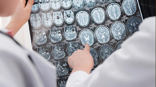 脑溢血病人如何康复训练