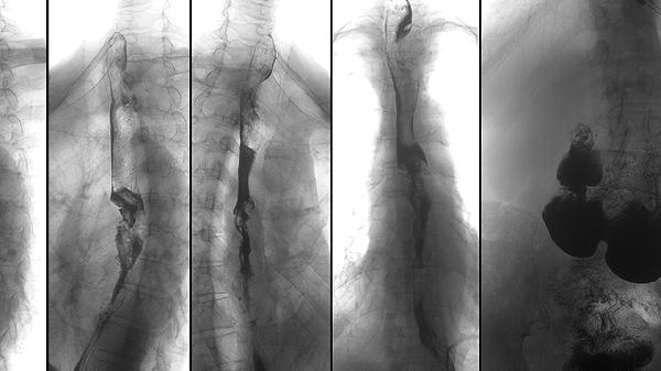 脊柱外科和骨科的区别
