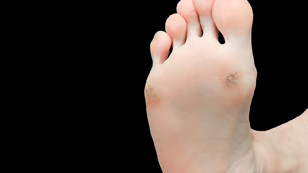 脚痛一直痛到屁股是怎么了