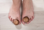 男朋友吸完乳头后会退一层干皮 全面解析与实用指南