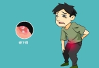 梅毒患者日常生活中要注意哪些方面的问题