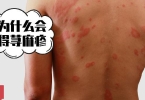 得了荨麻疹为什么造成食道难受呢