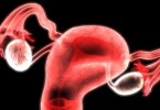 张家口女性在线咨询免费:腺肌症吃地诺孕素片要吃多久？地诺孕素标准疗程多长