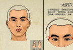 脂肪可以填充太阳穴吗