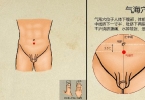 疝气中医辨证治疗
