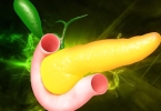 急性胰腺炎的体征有哪些