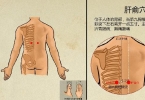 中医治疗鸡眼的效果怎么样