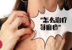 急性荨麻疹的原因
