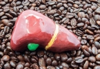 肝功能异常人血白蛋白低