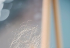 脱发养护指南PRP治疗 PRP注射对脱发有效果吗