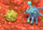 甲状腺结节CA是癌症吗