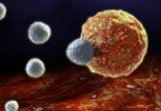 淋巴细胞低是感染了hiv了吗