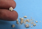 最有效的结石治疗方法