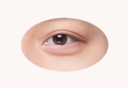 做双眼皮的注意事项是什么