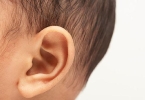 内耳畸形属于先天性耳聋吗