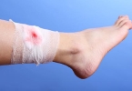 男生大腿根内侧痒是什么原因