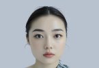 激光洗眉半年了不消肿怎么办