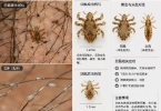 阴虱多久才会被发现
